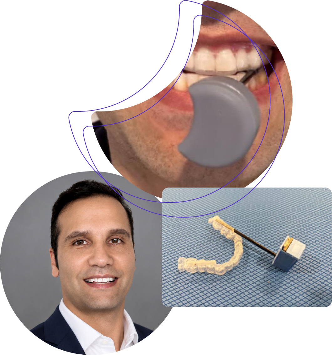The Personal Story Behind Zerene: Why I Chose Biofeedback for My Bruxism