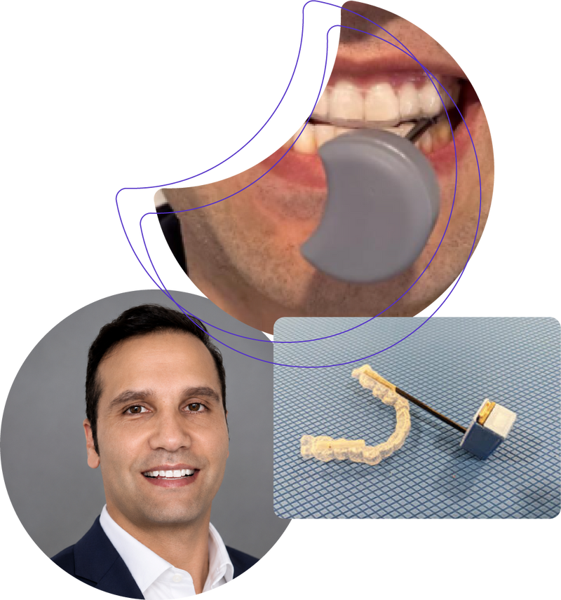 The Personal Story Behind Zerene: Why I Chose Biofeedback for My Bruxism