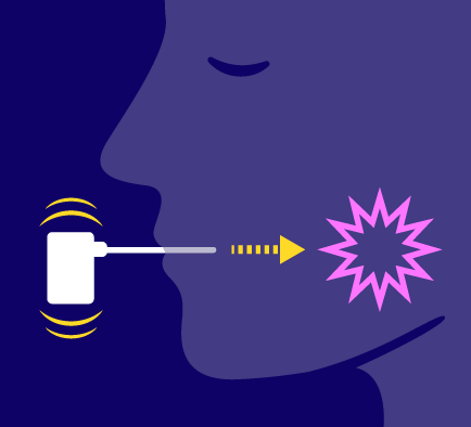 Illustration of Zerene device delivering biofeedback to grinding teeth with a purple background