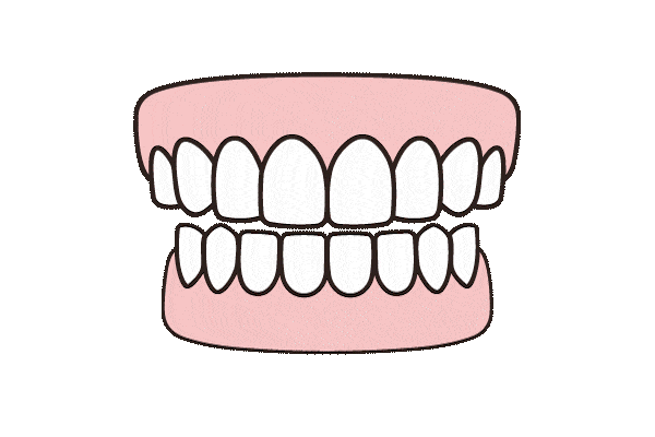 Animated graphic demonstrating 3 types of bruxism