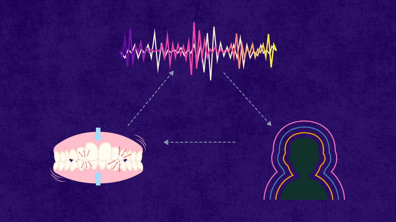 Treating Bruxism – Biofeedback Methods May be Effective