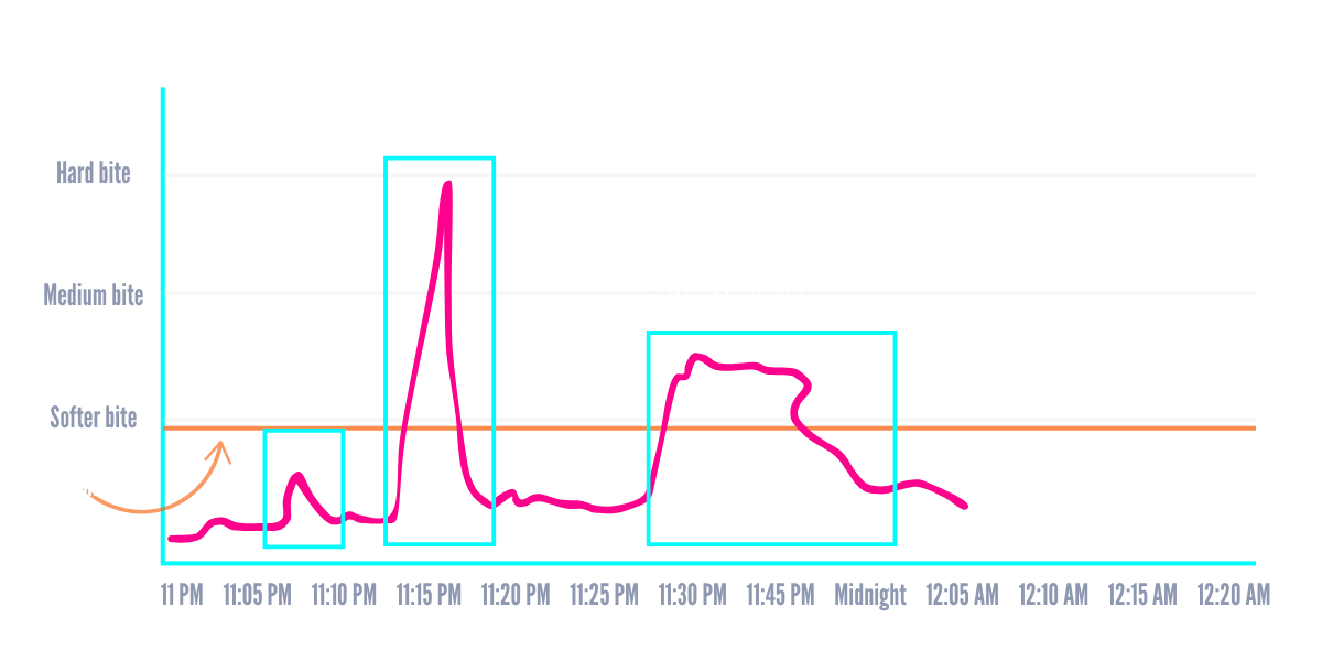 Zerene - Z-Score (2)