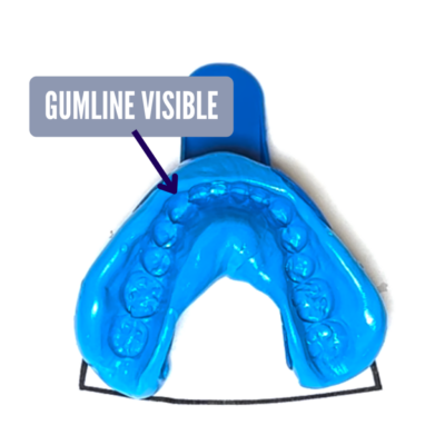STEP 7: Repeat these steps to create an impression of your LOWER teeth Note: For most people we recommend that you submit both upper and lower impressions. However, it is ok to submit one or the other depending on your preference or dental situation. If you are unable to submit either upper or lower impression due to dental appliances or other reasons, please communicate with your Zerene Coach at coach@zerenelife.com